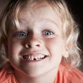 Liječnici savjetuju roditeljima da mliječne zube djece ne bacaju