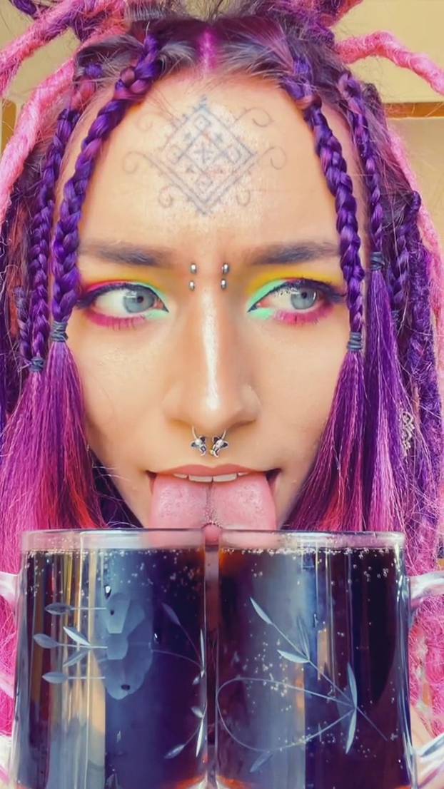 VIDEO: 'I had to relearn how to talk and kept dribbling on my chin after getting extremely painful tongue split'