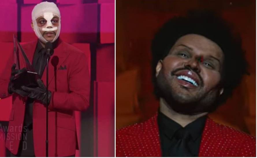 The Weeknd šokirao gledatelje transformacijom lica: 'Užas...'