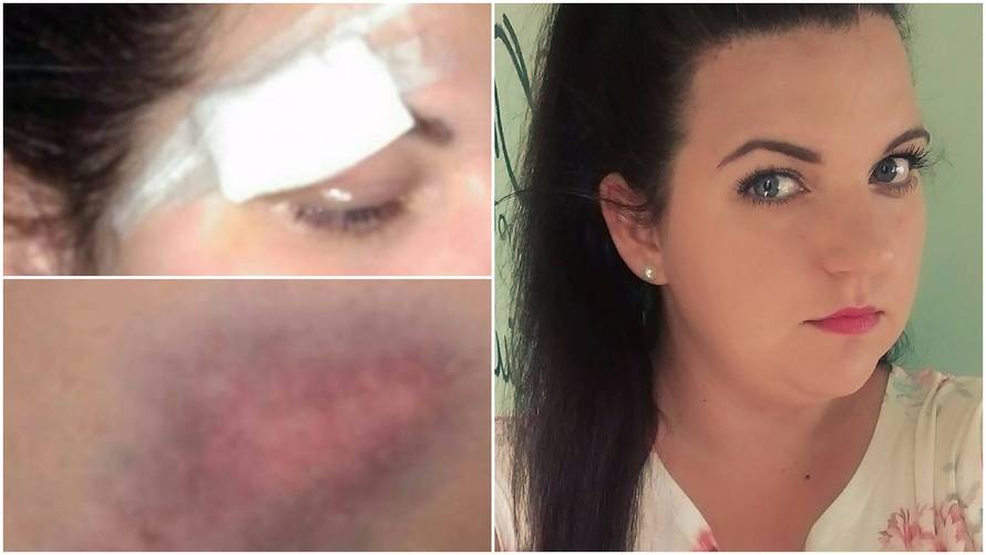 Barbi iz 'Farme': Bivši dečko me pretukao, dosta sam šutjela