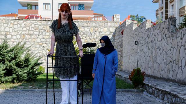 World's tallest woman Rumeysa Gelgi holds a news conference in Karabuk