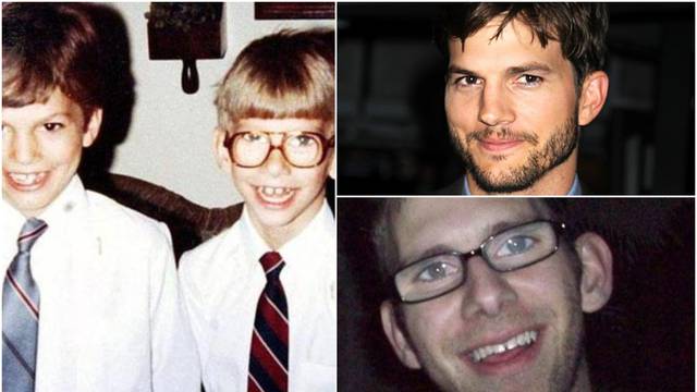 Brat blizanac Ashtona Kutchera: 'Bio sam jako ljut što je javno govorio o mojoj teškoj bolesti'
