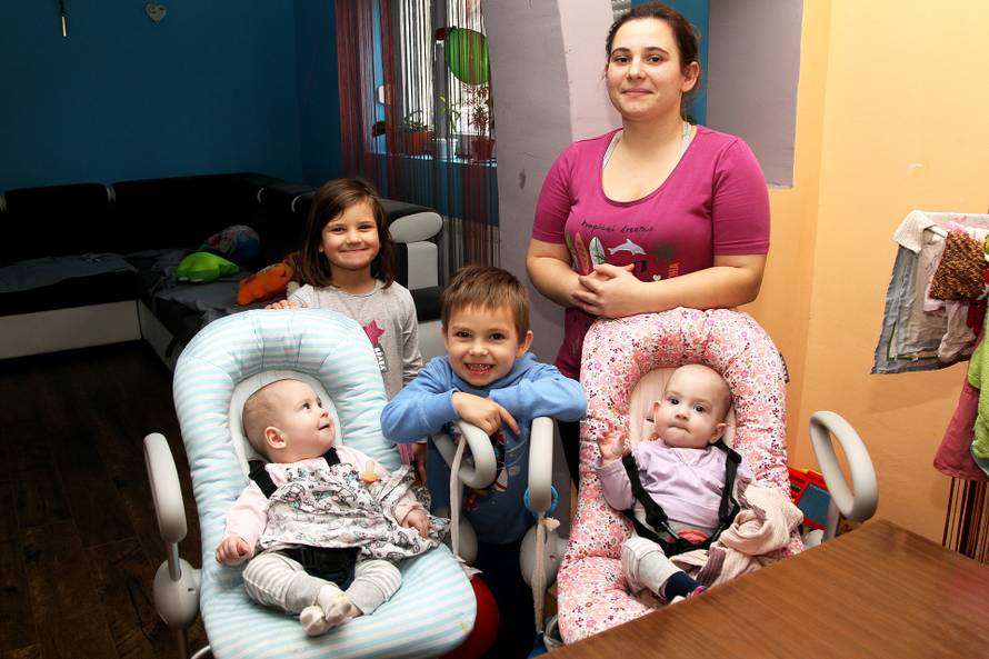 Sijamske blizanke: Seke su bile spojene, imale su zajedničku jetru, a danas su zdrave i vesele