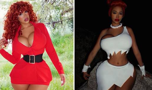 FOTO Bujni model: Na operacije sam potrošila 105.000 €, želim izgledati kao superjunakinja!