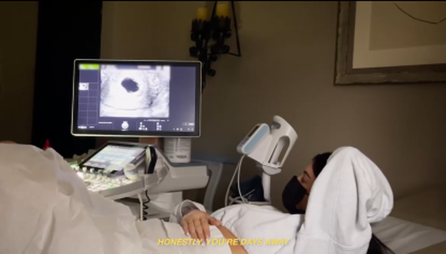 Kylie Jenner objavila snimku s ultrazvuka: Stiže druga beba