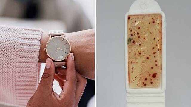 Koliko često očistite ručni sat? Ima više bakterija nego u WC-u