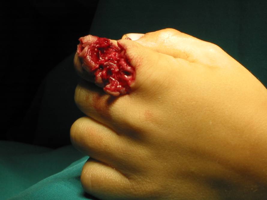 Evo zašto su zabranili petarde: Stravične snimke iz Klaićeve