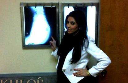 Dokaz da je prirodna: Kim je svoju guzu snimila rendgenom