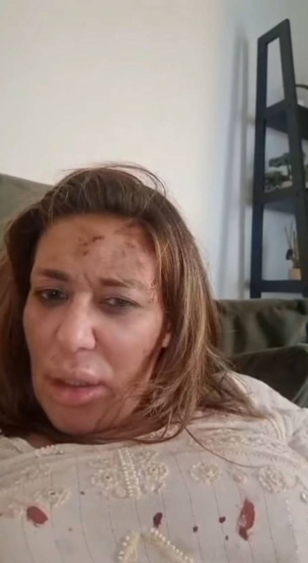 FOTO Drama između Ane Nikolić i Raleta ne prestaje, a evo kako se ona mijenjala kroz karijeru...