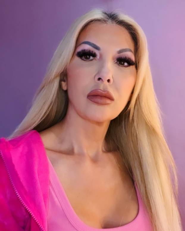 FOTO 'Bila sam muškobanjasta, ali uložila sam u izgled i sada sam savršena poput Barbie!'