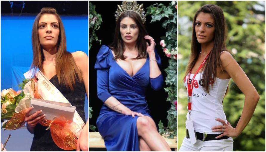 Naša bivša misica ima potpuno 'novo lice': Pogledajte kako sad izgleda nakon estetskih zahvata