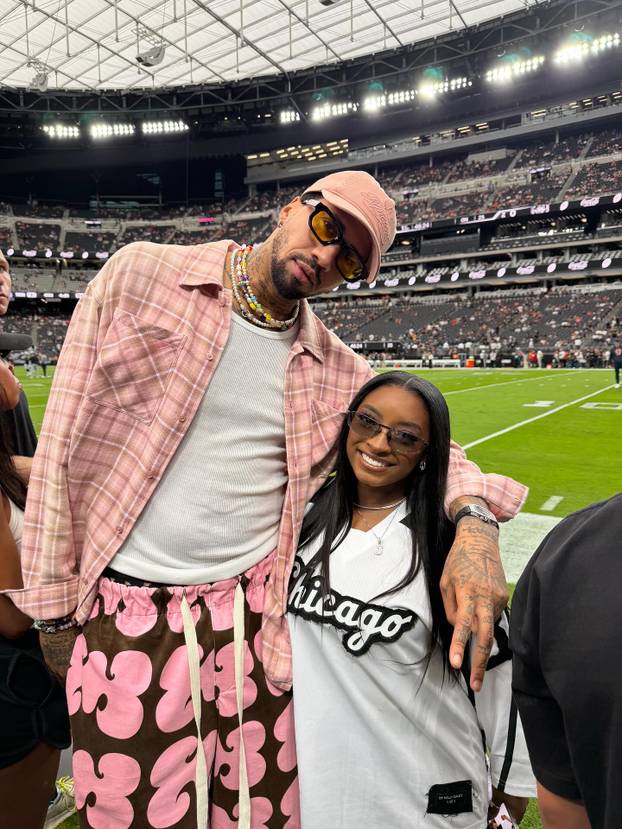 FOTO Olimpijska legenda: Imala sam tri plastične operacije. Za dvije ne biste mogli pogoditi...