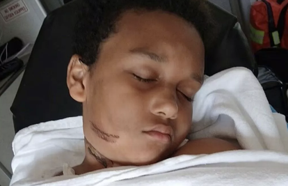 UŽAS! Punjač se zapalio dok je dječak spavao, spržilo mu vrat!