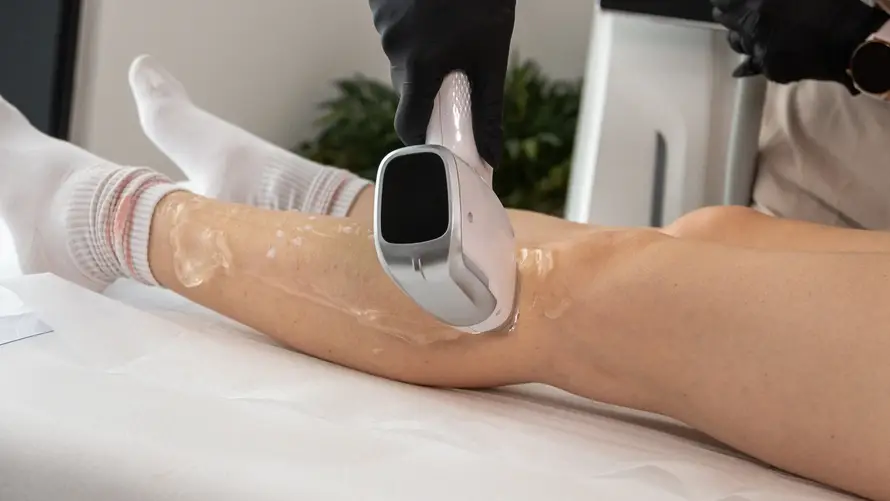 Revolucija u svijetu ljepote: Zašto je medicinski laser jedini pravi put do glatke kože?