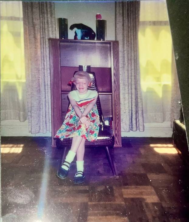 FOTO Afrikanka s albinizmom osvaja modnu industriju: 'Često privlačim znatiželjne poglede'