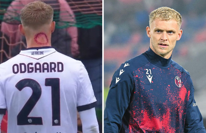 Zaigrao s jezivim ožiljkom na vratu: 'Nije me ugrizao zombi!'