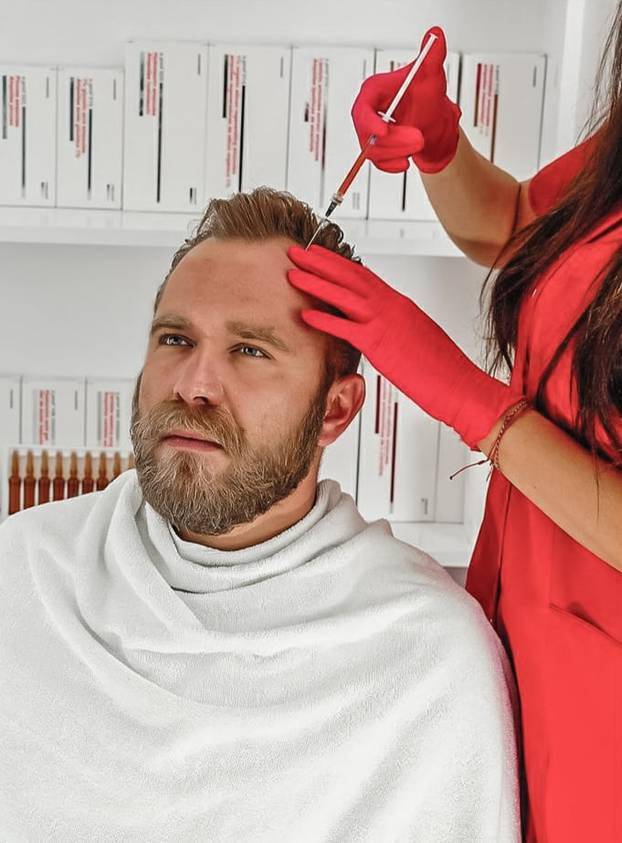 FOTO Zbogom, ćelavosti! Ovi su slavni muškarci presadili kosu: Ovako su izgledali nekada i sad