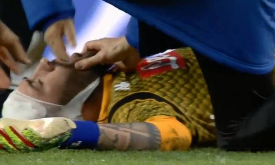 Jesu li liječnici krivi? Istraga u Napulju, Ospina ostaje u bolnici