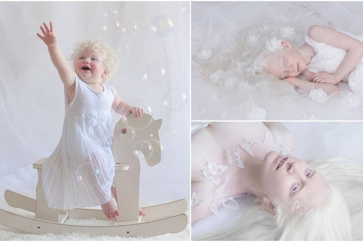 Svojim fotografijama prikazuje jedinstvenost ljudi s albinizmom