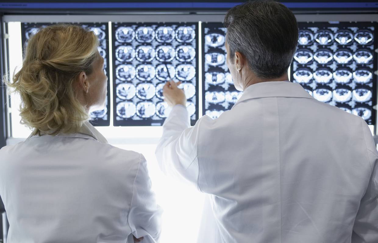 Virus herpesa mogao bi igrati ulogu u razvoju Alzheimera