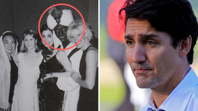 Trudeau se ispričao: 'Da, bojao sam lice u crno, nisam to smio'
