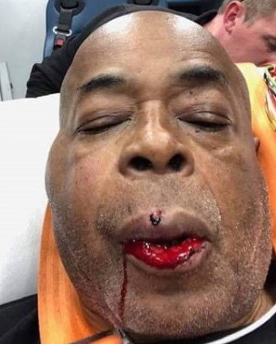 Ivana Habazin borit će se i za teško bolesnu "drugu majku"