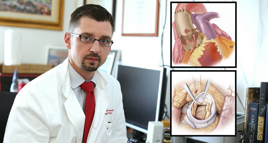 Rekonstruiraju srčane zaliske: Pacijenti sedmi dan idu kući...