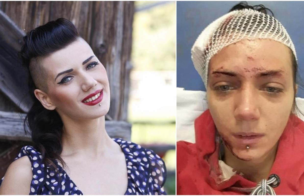 'Napao me sjekirom, a pustili su ga da se brani sa slobode'