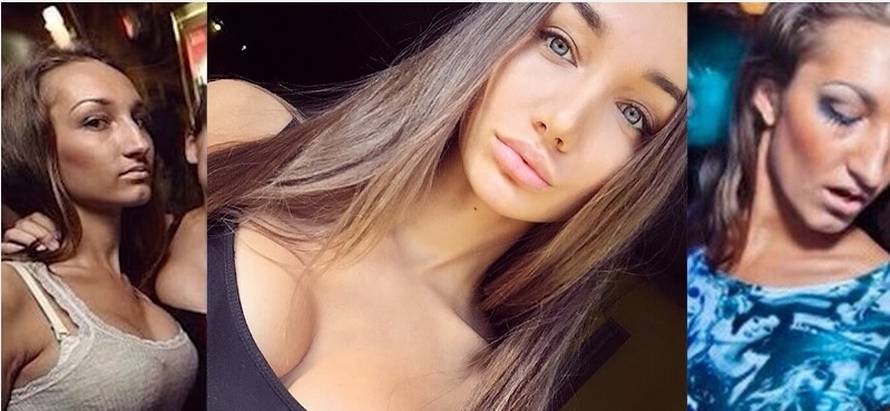 10 seksi zvijezda Instagrama: Ovo su one prije operacija!