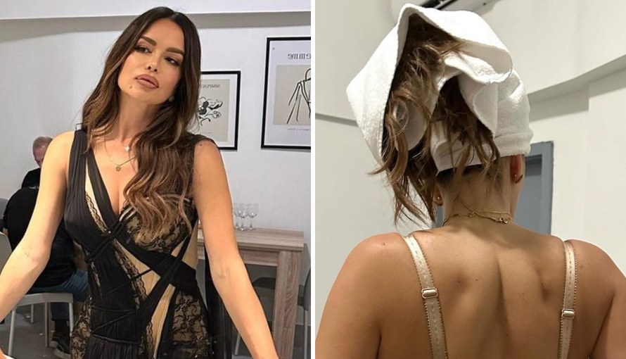 Severina pokazala 'posljedice' nakon svog koncerta: 'I onda svi misle kako je lako biti ti...'