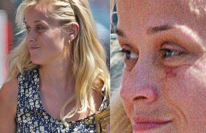 Reese, Madonna i Britney Spears ozlijeđene na radu