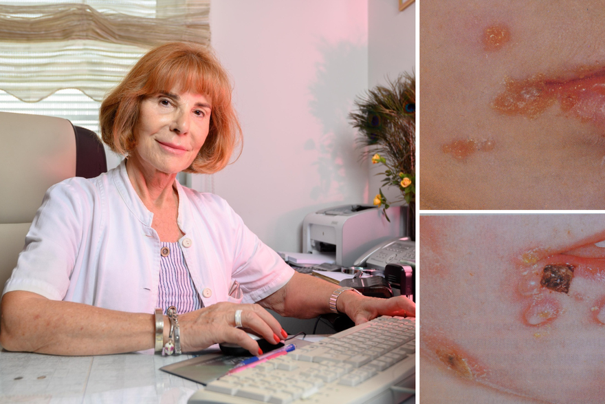 Zadar: Gordana Bubičić-Bajek, specijalistica dermatovenerologije