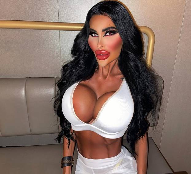 FOTO Potrošila više od 100 tisuća eura kako bi izgledala kao 'ljudska barbika' - Liječnici zgroženi