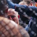 VIDEO Užasna ozljeda na UFC-u: Mislio sam da mi je iskopao oko