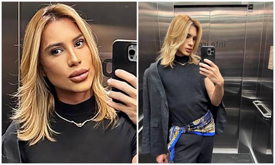 Preminuo poznati influencer: Htio je 'mačji' izgled, a tvrdio je da mu je oči operirao zubar