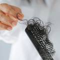 Frizeri otkrili: 5 znakova da vam kosa ispada više od normalnog