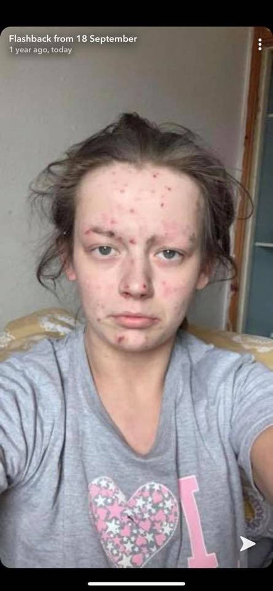 Bivša ovisnica o heroinu i majka dvoje djece pokazala kako sada izgleda: Naudila sam kćerkici...