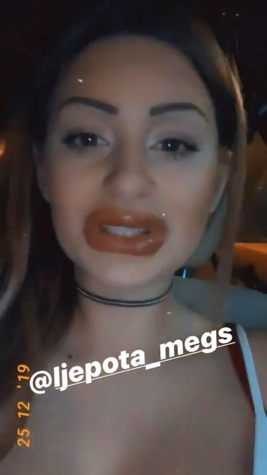 Tako mlade, a tako napumpane: Hana i Mandarine trče pod nož