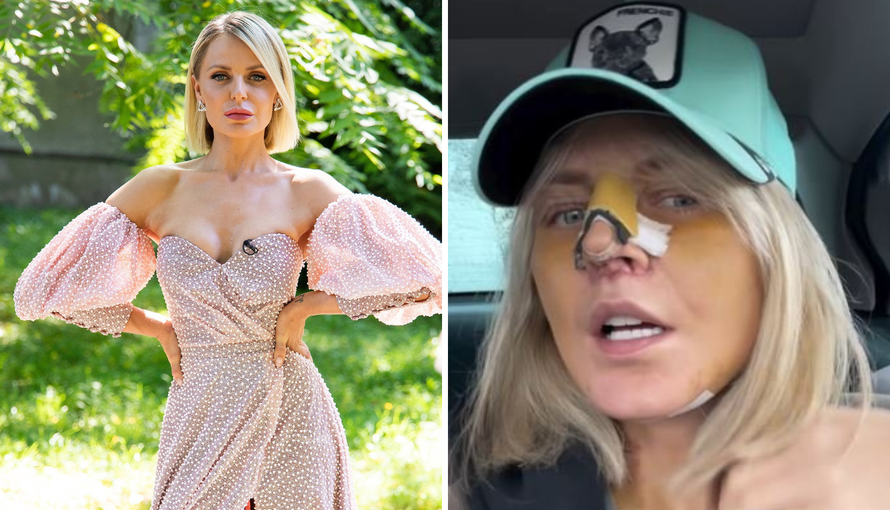 Stankica iz 'Savršenog' uklonila filere: Operacija je trajala 9 sati