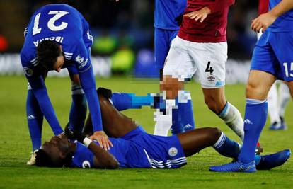 Uznemirujuće! Igrač Leicestera slomio je gležanj kao Eduardo