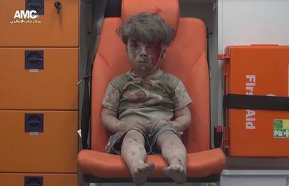 Prizor koji slama srce:  Ranjeni dječak postao je simbol Alepa