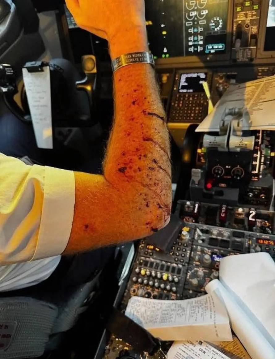 Boeing 737 u letu pogodio je “misteriozni objekt”. Pilot pokazao ozljede na rukama