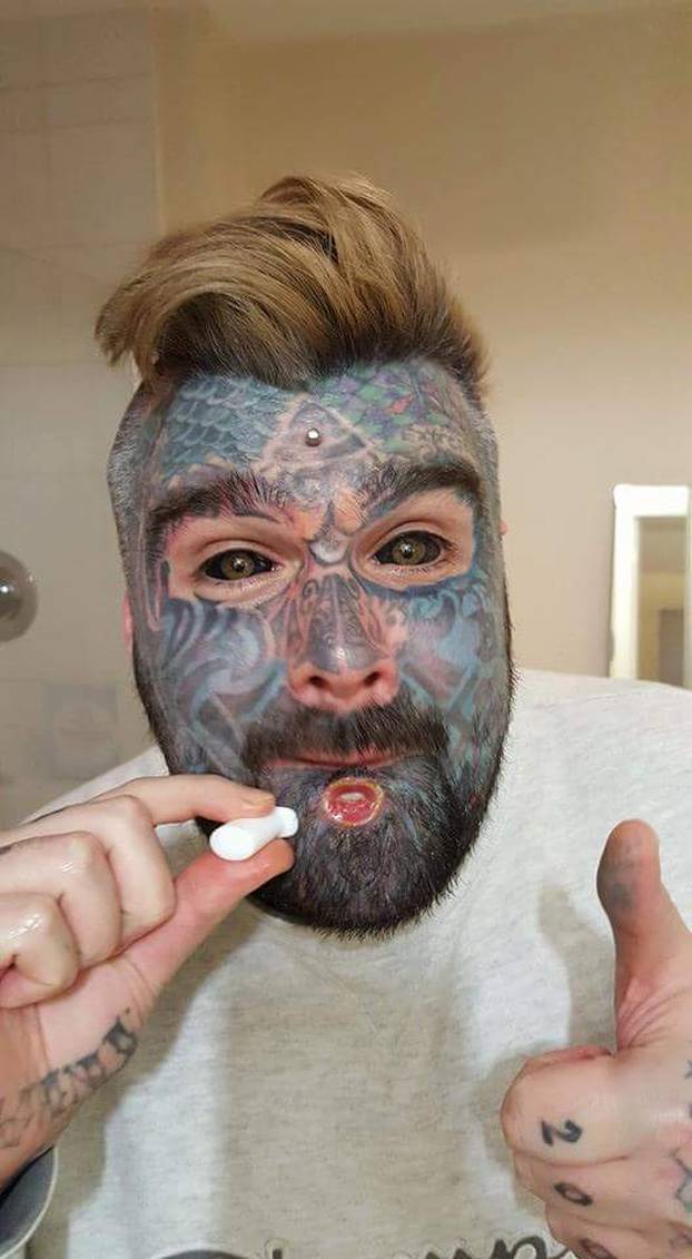 FOTO Više mu ne stane nijedna tetovaža! Uklonio je i bradavice. Evo kako je prije izgledao: Wow