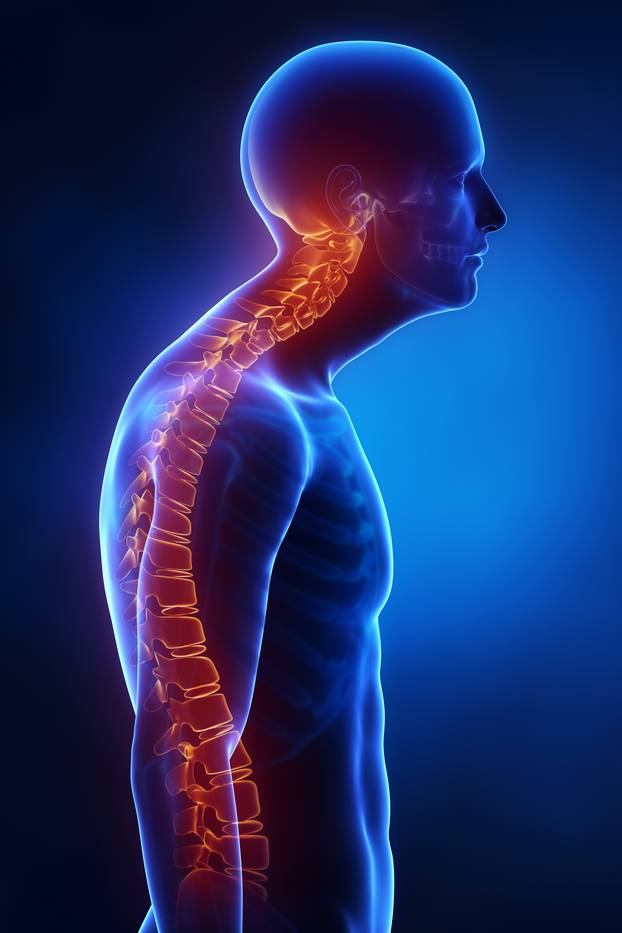 Kyphotic spine lateral view in x-ray