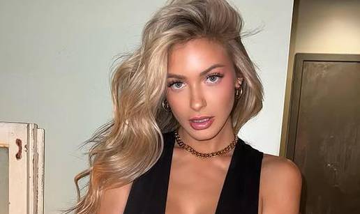 FOTO Zbog njenog izgleda gore dru&scaron;tvene mre&zcaron;e: &Zcaron;ivim na visokoj nozi. Nitko mi nije ravan