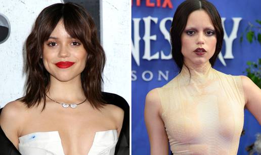 FOTO Potpuno su se izobli&ccaron;ili: Radi popularnog zahvata brojni slavni izgubili su svoju ljepotu