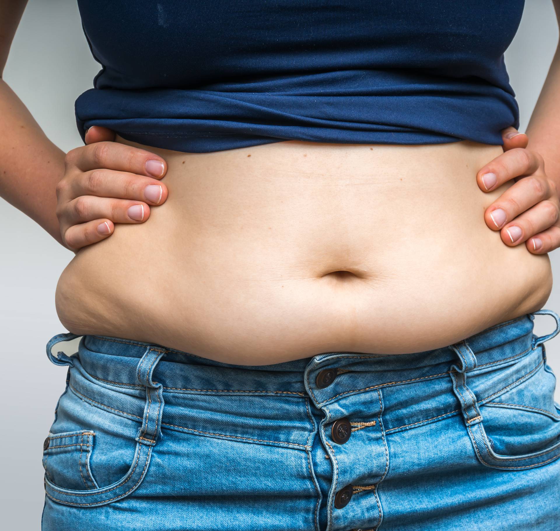 6 razloga zašto imate oveći trbuh, a većina nije zbog hrane