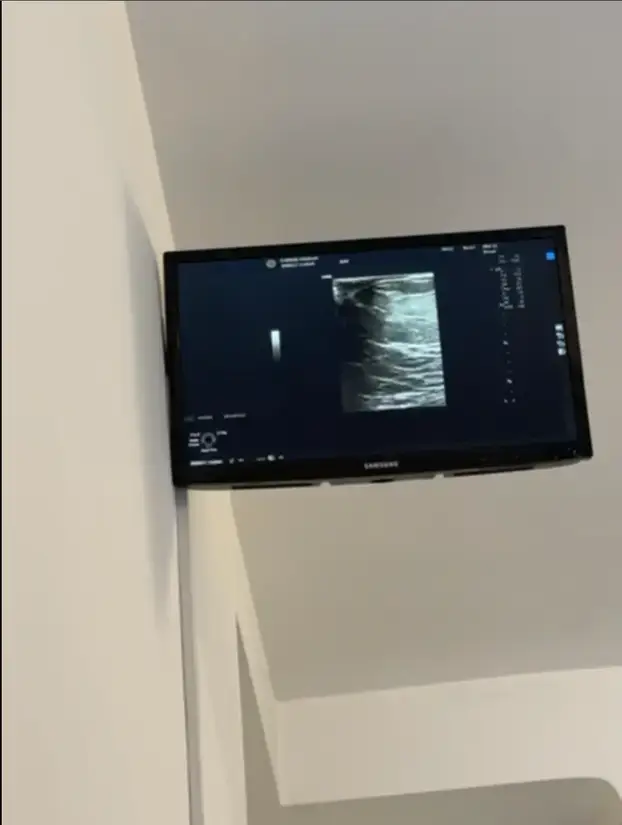 FOTO Bujnoj Slavonki ne vjeruju da ima prirodne grudi. Poslala je dokaz: 'Evo vam ultrazvuk!'