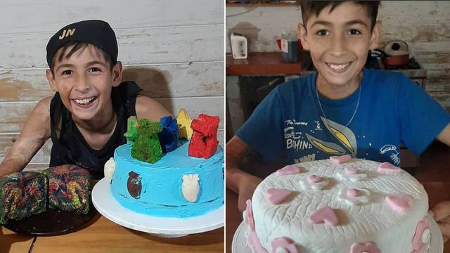 Desetogodišnji Joaquin prodaje kolače kako bi zaradio novac za rekonstrukciju opečene kože lica