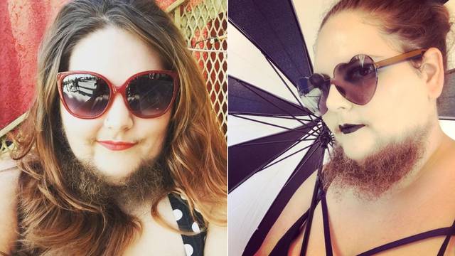 Amerikanka od svoje 13. godine lice brije dva puta dnevno: 'Najseksi sam s punom bradom'